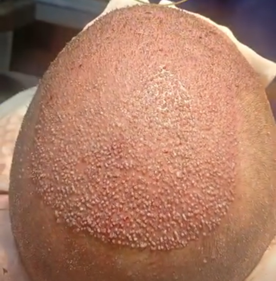 101